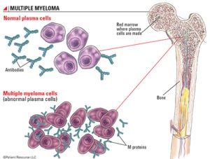 multiple myeloma research foundation