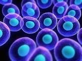 Myeloma-Overthinking Autologous Stem Cell Transplant? - PeopleBeatingCancer